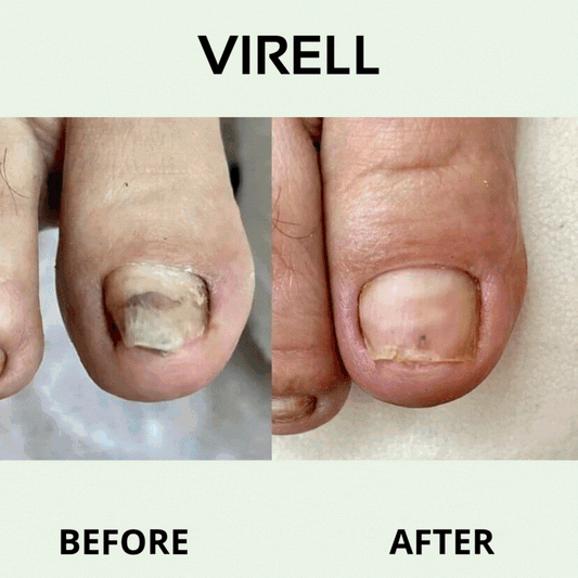 Virell - Nail care pen