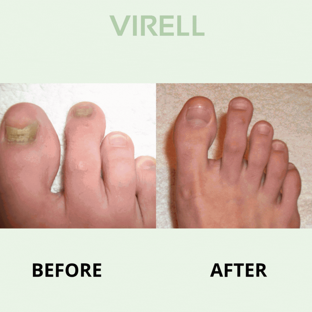 Virell - Nail care pen