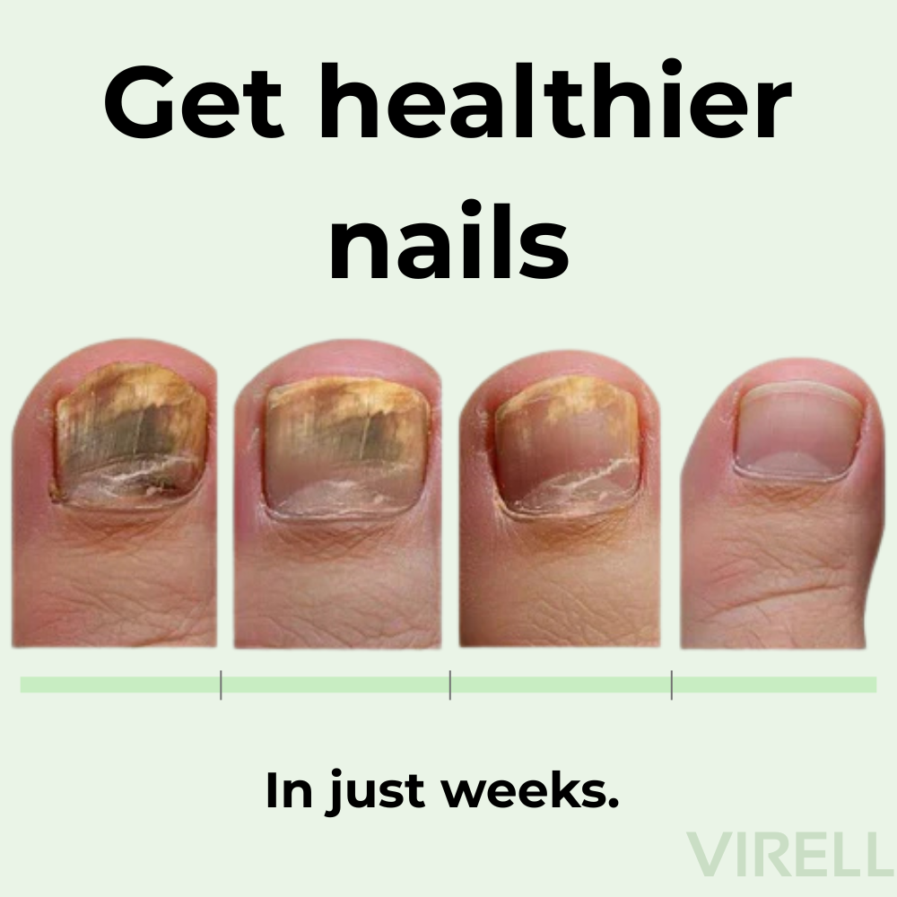 Virell - Nail care pen