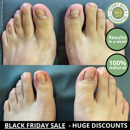 Virell - Nail care pen