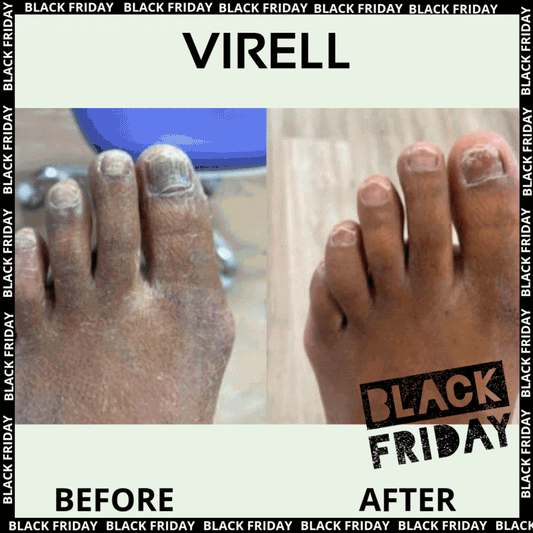 Virell - Nail care pen