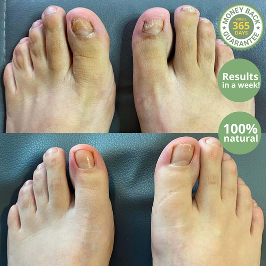 Virell - Nail care pen