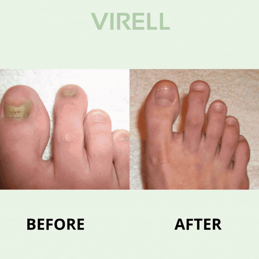 Virell - Nail care pen